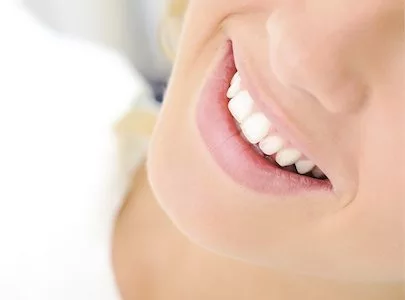 Close-up of a woman's smile after dental bonding services